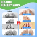 Universal laser pen man and woman finger health tool blue light laser - Image 5