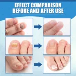 Universal laser pen man and woman finger health tool blue light laser - Image 3