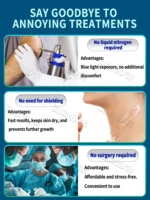 blue light pen solve scar,scar care tools, unisex,2025 hot sale - Image 5