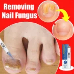 Universal laser pen man and woman finger health tool blue light laser