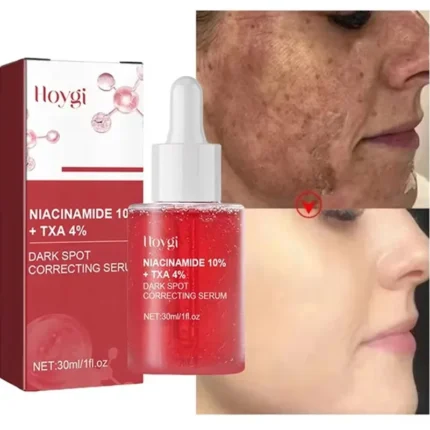Niacinamide Dark Spot Remove Serum Face Freckle Melanin Correcting Moisturizing Brightening Anti Pigmentation Repair Skin Care